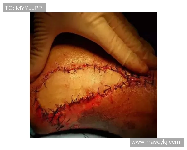 足球明星险遭截肢的惊险经历与重返赛场的励志故事